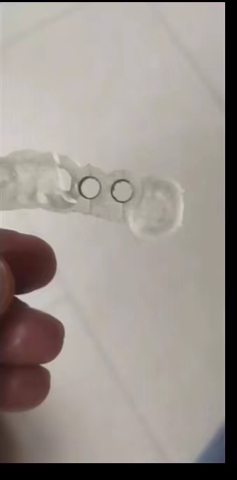 Reçine Diş 3D Yazıcı Dikim Kıl - 3D Printing Dental incelemesi ve fiyatı