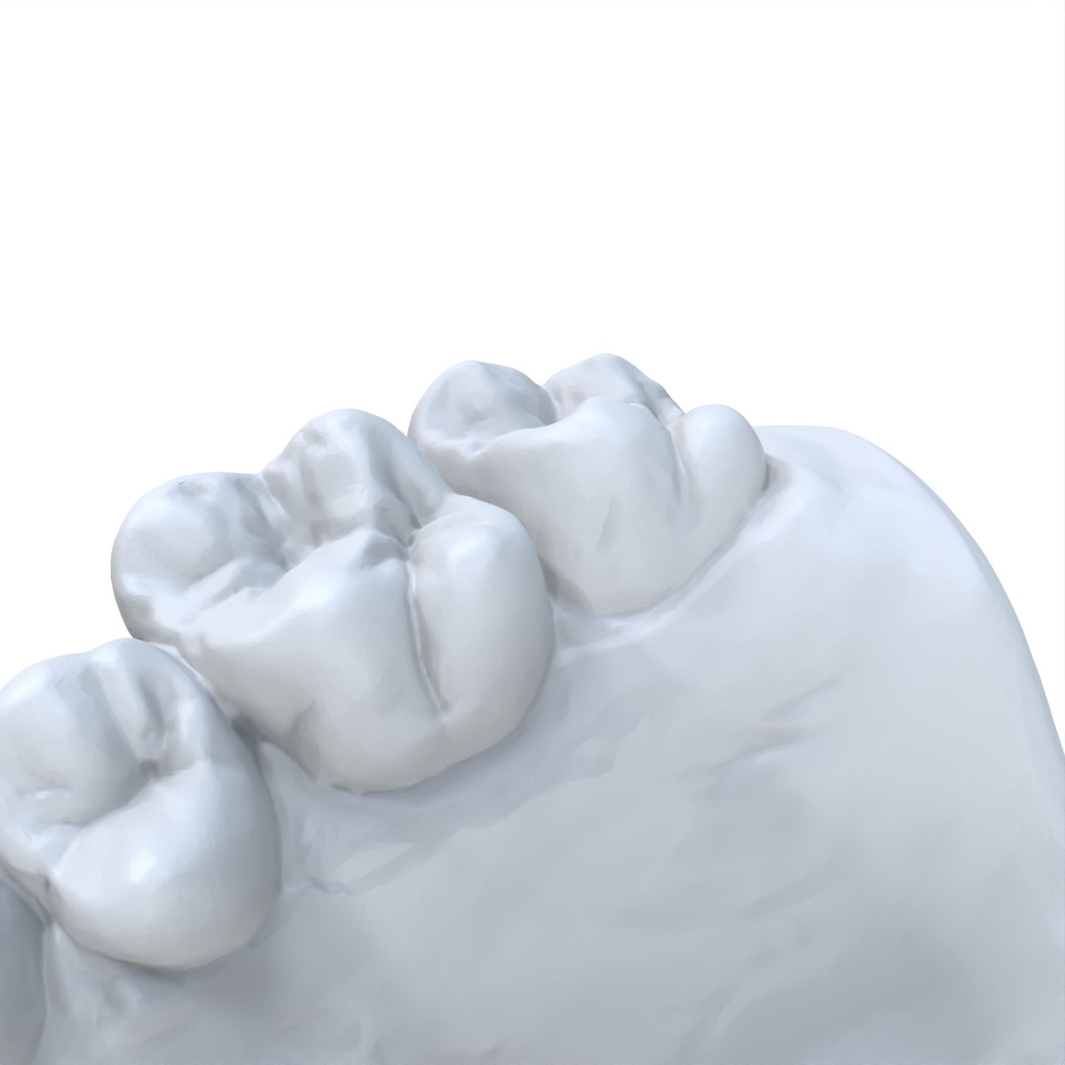 1 adet diş modeli tercih edile - 3D Printing Dental incelemesi ve fiyatı